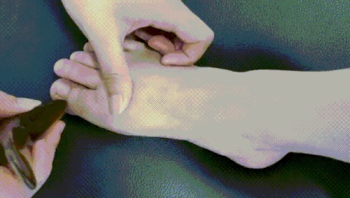 按揉隱白穴 按揉隱白穴