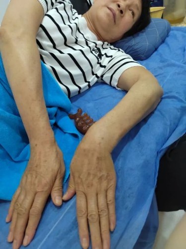 躺在床上的患者 躺在床上的患者