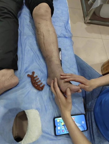 患者開始出現(xiàn)好轉(zhuǎn) 患者開始出現(xiàn)好轉(zhuǎn)