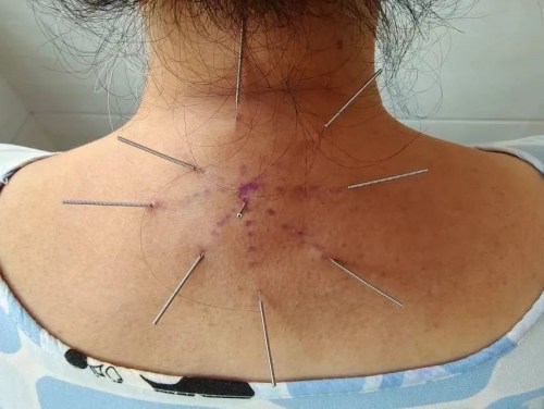 富貴包調(diào)理 富貴包調(diào)理