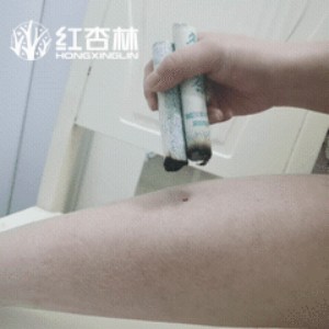 紅杏林中醫示范艾灸豐隆穴