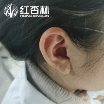 紅杏林中醫動作示范 紅杏林中醫動作示范