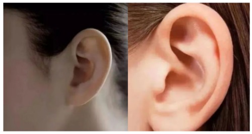 耳朵的區別 耳朵的區別