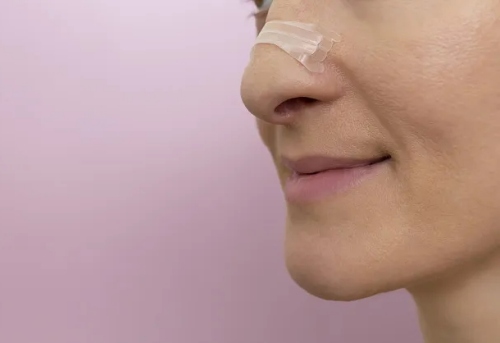 嘴唇發紫 嘴唇發紫